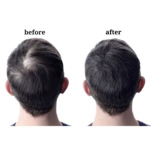 1B60 Side Or Back Hair Patches 8x8 cm Full Skin PU Base Toupee For Men Covering Bald Spots On Head Sides Or Back - Image 33