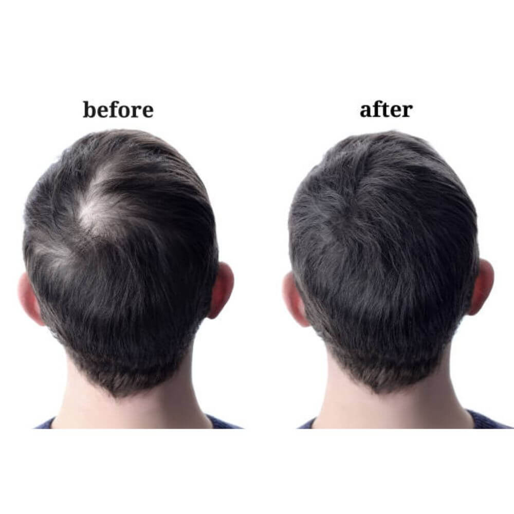 1B60 Side Or Back Hair Patches 8x8 cm Full Skin PU Base Toupee For Men Covering Bald Spots On Head Sides Or Back - Image 33