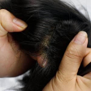 Hairpieces Replacement System For Men Swiss Lace Net With Half Pu Around Hair 100% European Remy Human Hair 10x8 - Image 3
